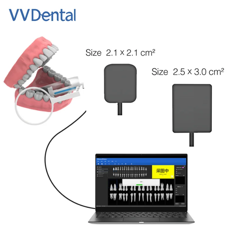 VV Dental Sensor X-Ray Digital Sensor Large Sensing Area Portable Intraoral Digital System HD Image Filming Dentistry Sensor