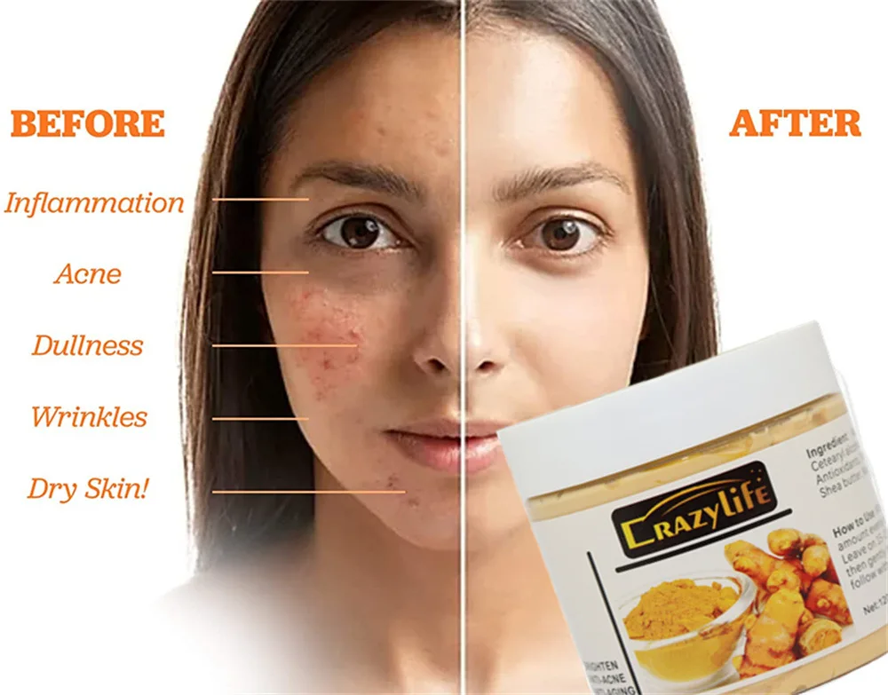 120gTurmeric Clay Mask Facial Cleaning Pores Dirt Acne Blackhead Anti-Acne Remove Deep Cleansing Oil control Whitening Skin Care