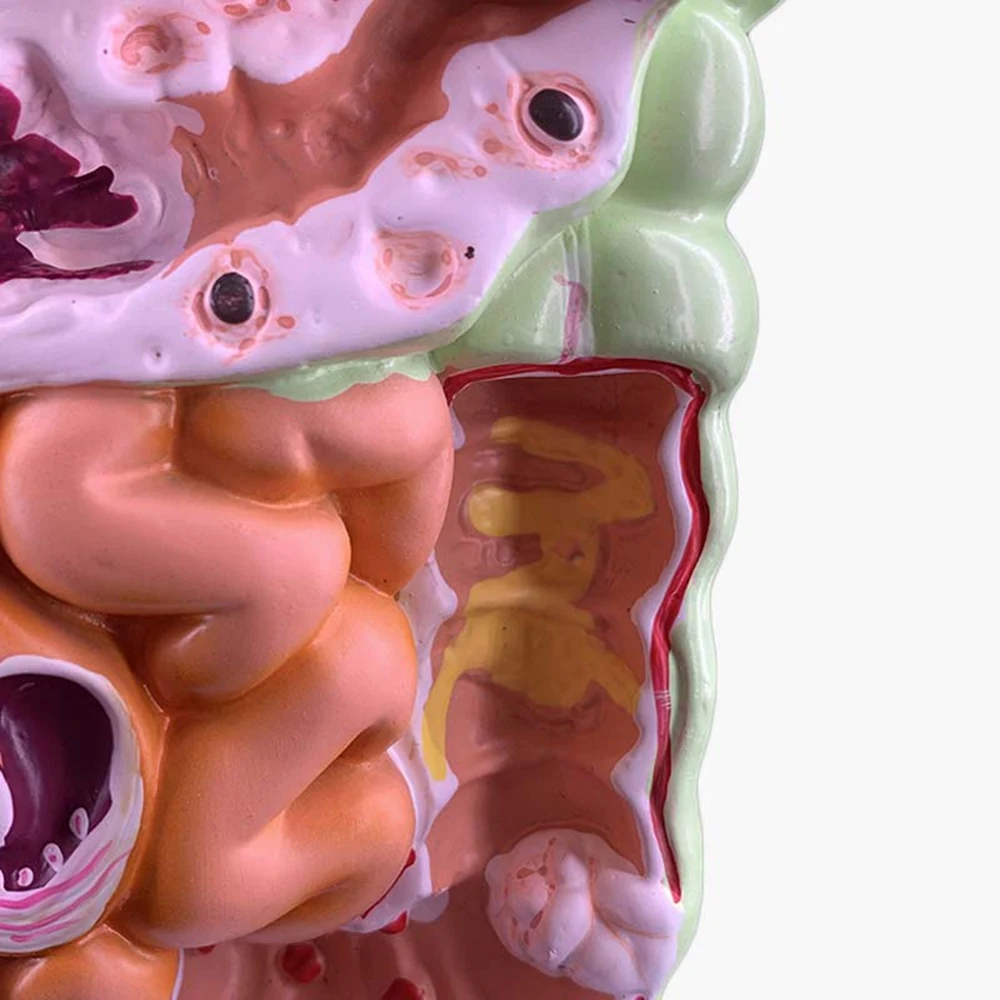 Modelo de sistema digestivo humano, anatomia do estômago, intestino grosso, cecum, reto, duodeno, órgãos internos humanos, modelo de estrutura