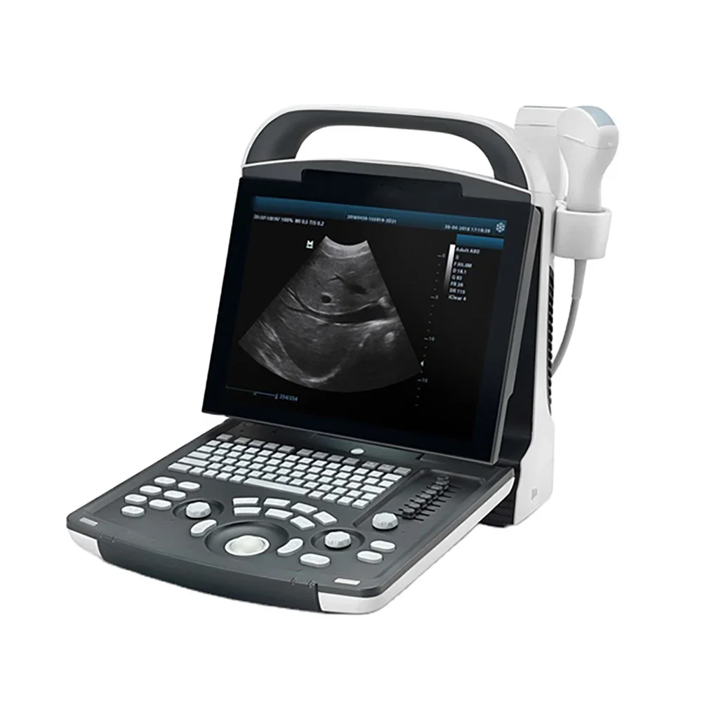 Mindray Dp 10 Portable Ultrasound Machine Price