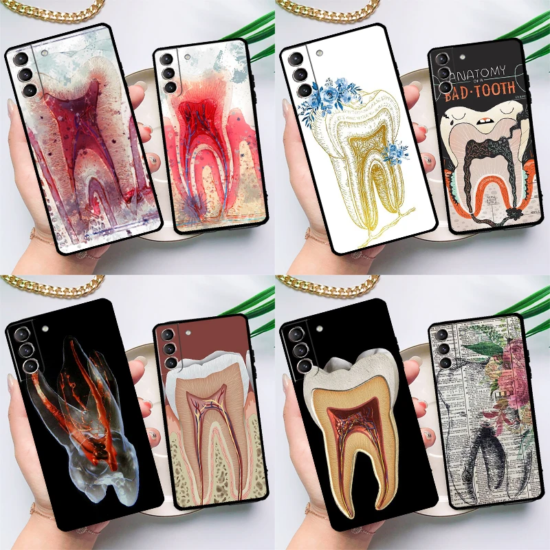 Human Tooth Anatomy Case For Samsung Galaxy S23 S21 S22 Ultra Plus Note 10 20 S8 S9 S10 Plus S20 FE Cover Case