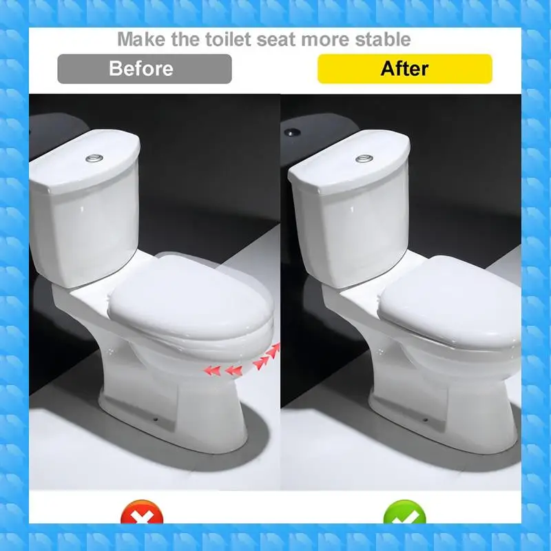 ETRT 2 PCS Heavy Duty Universal Toilet Seat Fastener Kit, Replacement Screws And Bolts For Toilet Seats