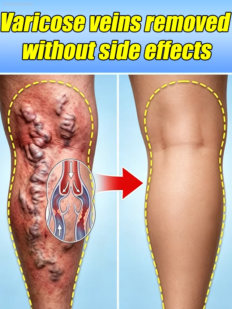 

Relieves leg discomfort, improves blood circulation, leg care.