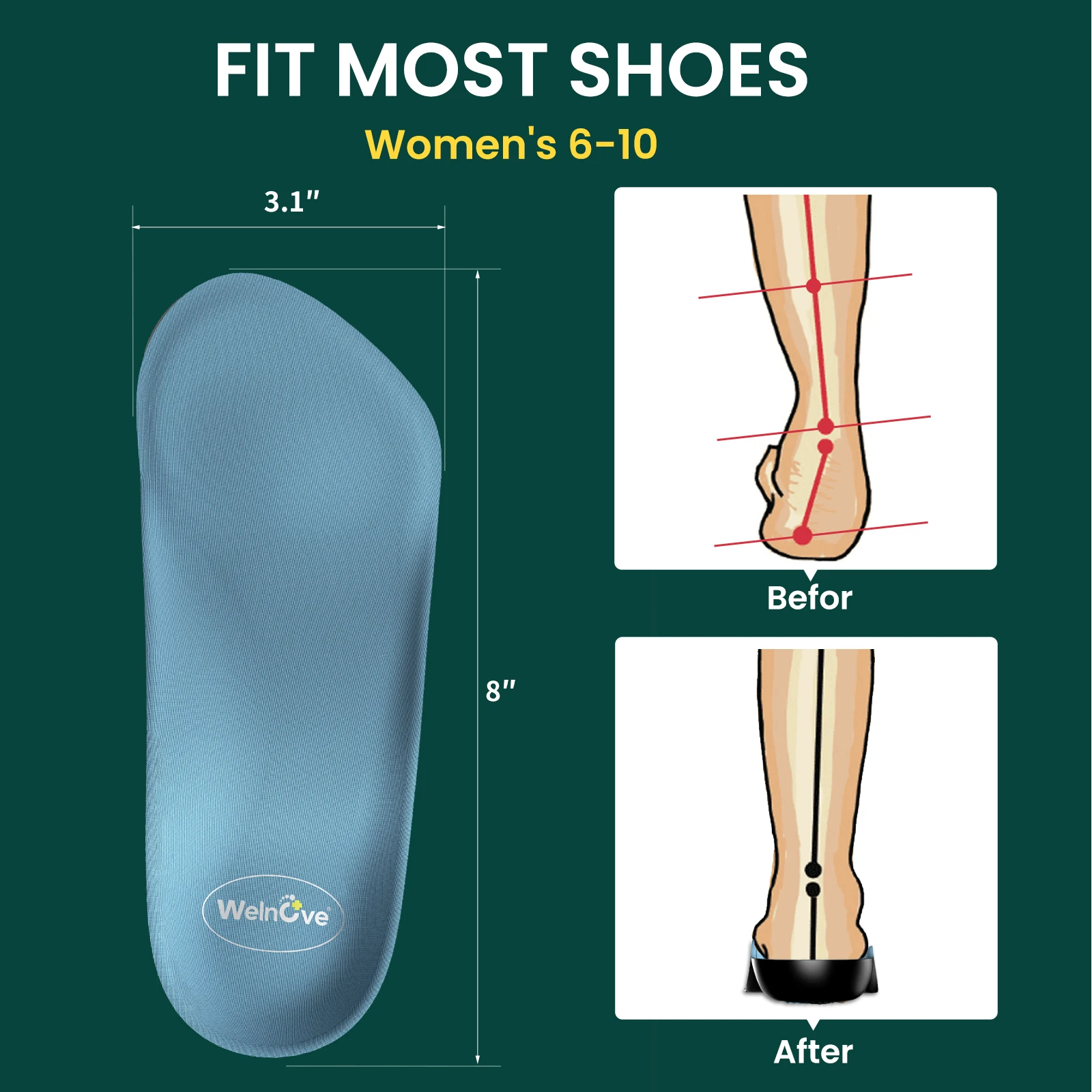2pcs Female Arch Support Pad Orthopedic Elasticity Insoles Shoe Sole Unisex Technology Shock Absorption Breathable Running Sport