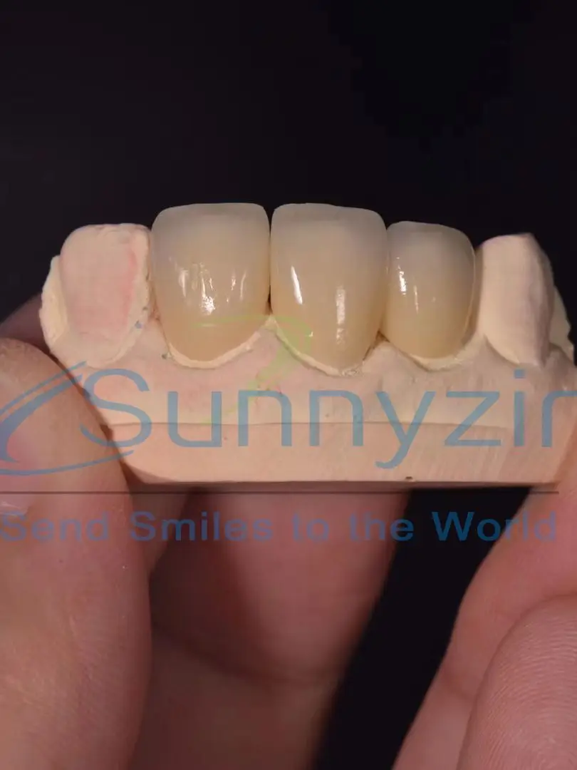 Sunnyzir White Zirconia Blocks Super Translucence High Strength Dental Materials For Dental Cad Cam Milling Machine in Lab