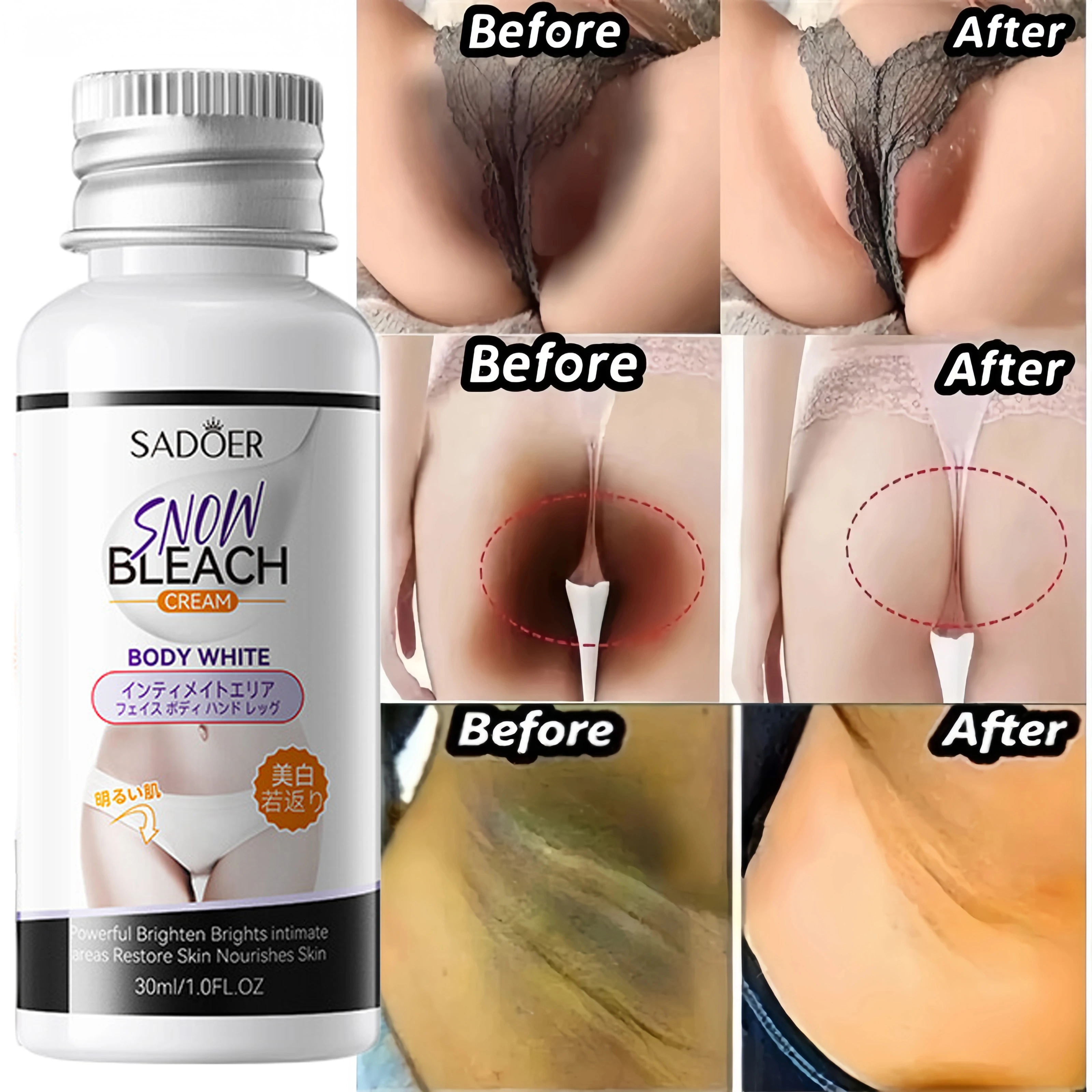 كريم تفتيح الجسم أجزاء خاصة تحت الإبط مصل تبييض بعقب الركبة الرقبة تفتيح الفخذ الداخلي الأجزاء الحميمة العناية بالبشرة الداكنة