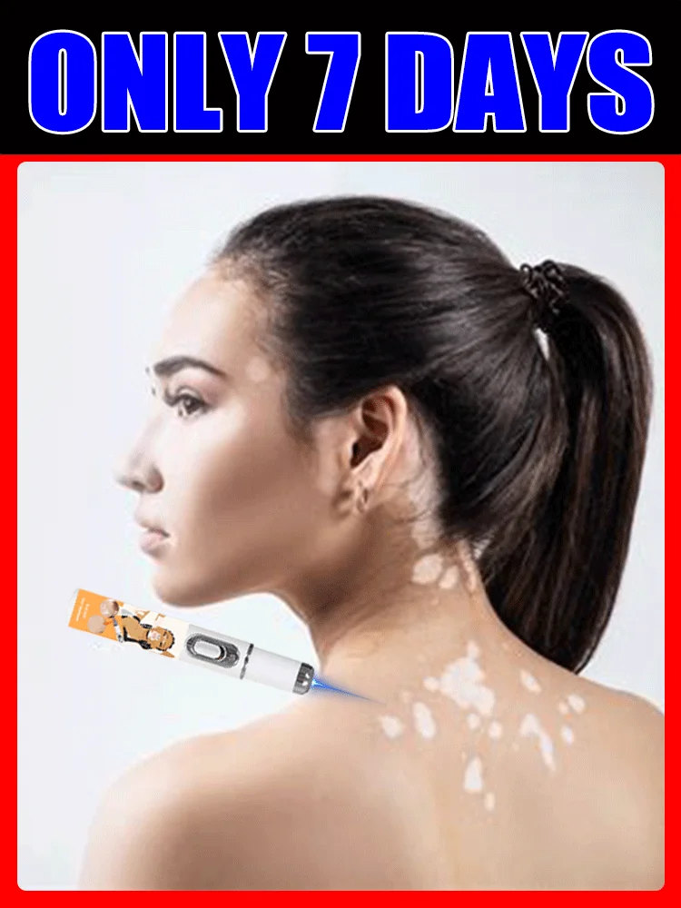 الليزر الأزرق يحسن البهاق، أدوات التمريض الأكثر مبيعًا في عام 2025