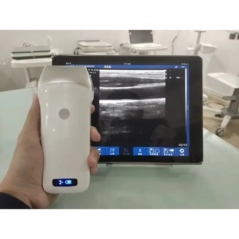 Cheap Deal Mini Handheld Veterinary/Medical Ultrasound Device UP-3C 250g Portable Wireless Probe 3.2/5.0MHz