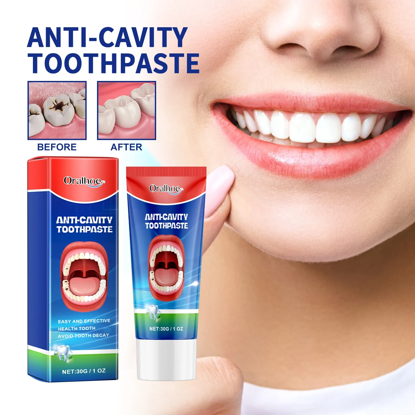 New Tooth Decay Prevention Toothpaste Effective Treatment Decayed Tooth Whitening Toothpaste Removal Yellow Toothpaste TeethCare