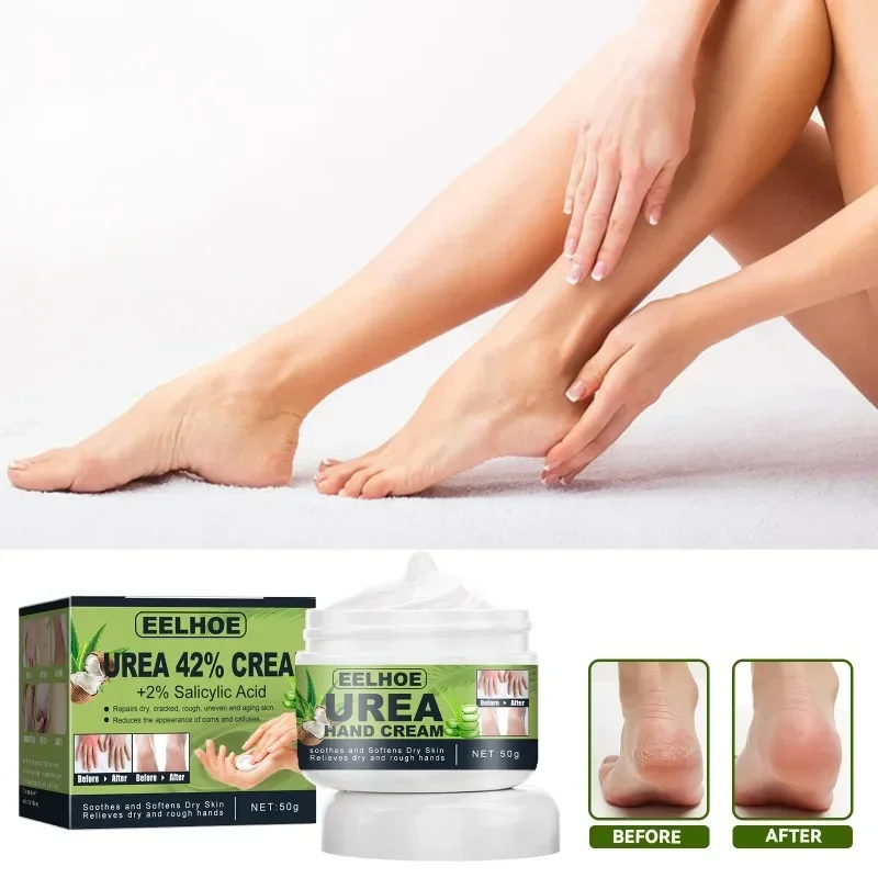 Sdatter Urea Cream Dry Cracked Feet Heels Hands Body Repair Exfoliating peeling Treatment Moisturizing Callus Dead Skin Remove F