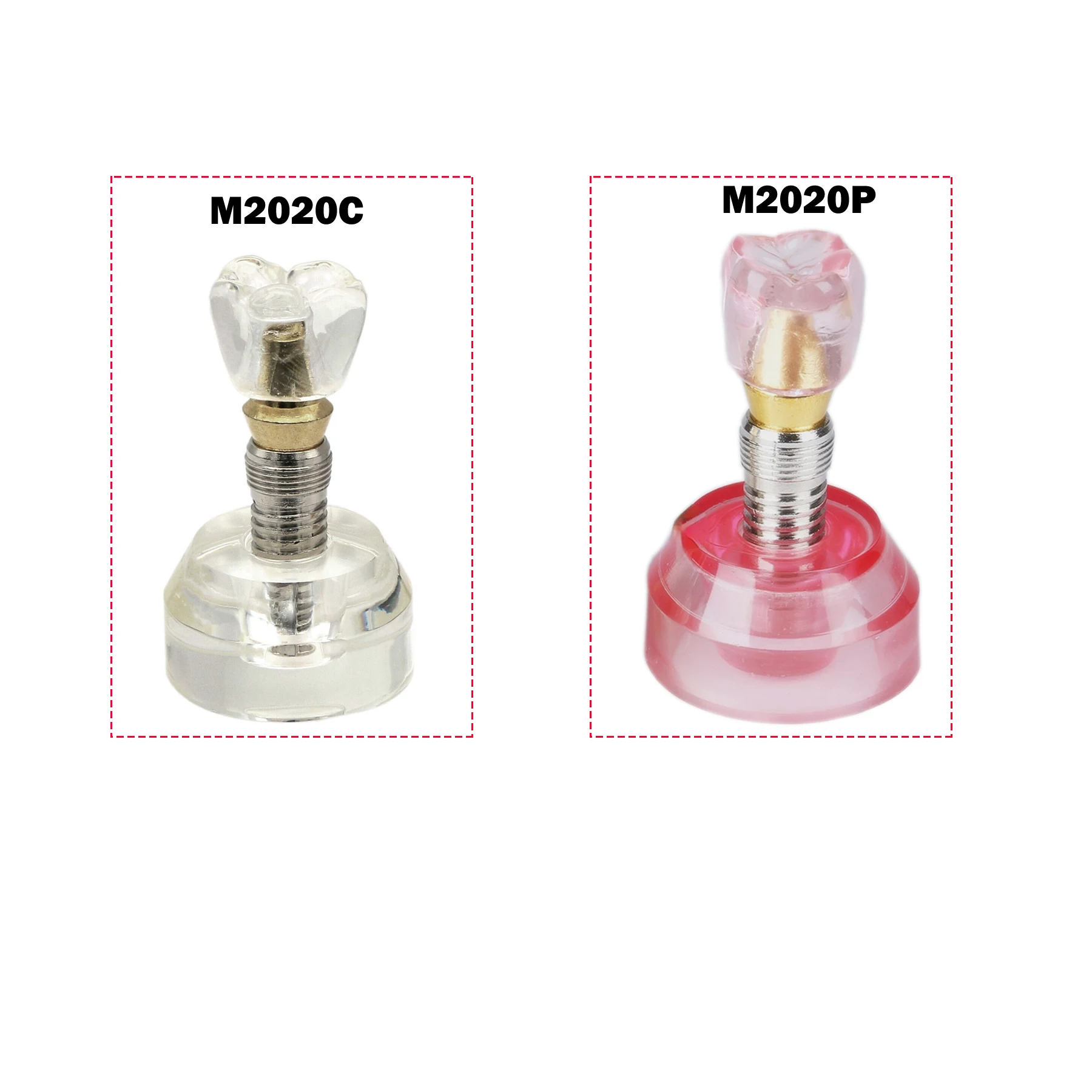 Стоматологическая модель 2,5x размера, модель имплантации зубов, обучающие модели зубов для стоматолога, связь пациента, демонстрационные аксессуары для стоматологии