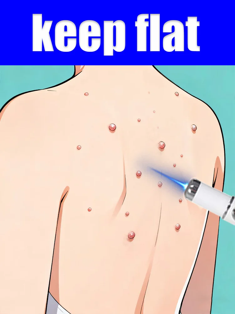 

A best-selling wart product online – say goodbye to warts in seven days!