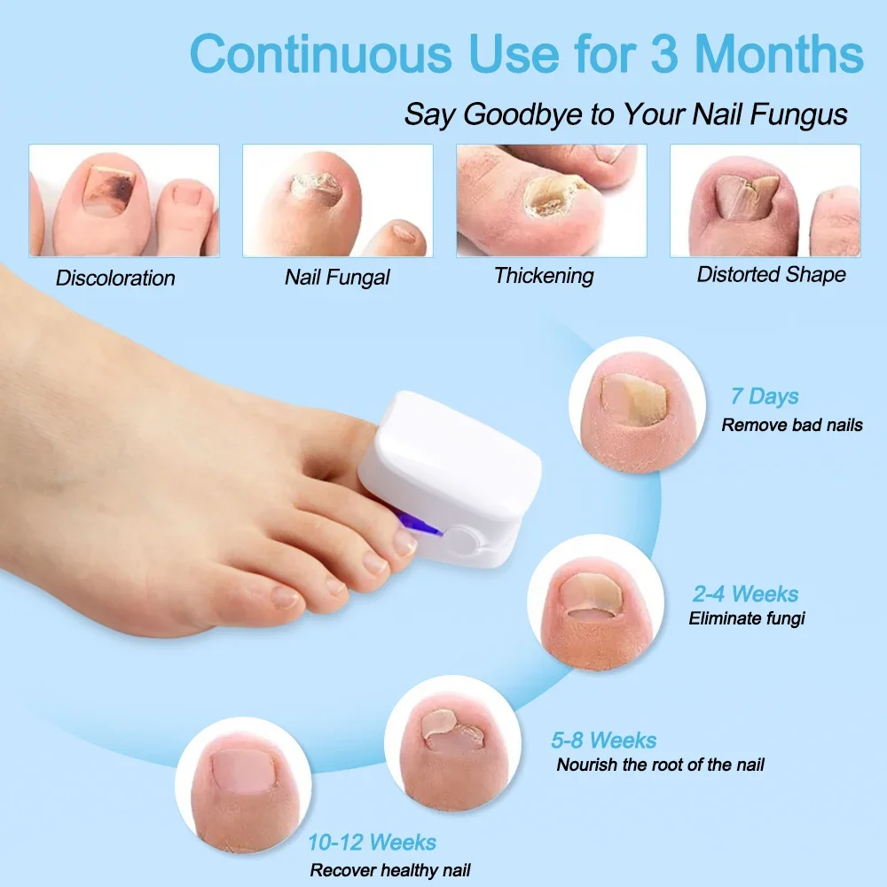 Nail Fungus Laser Treatment Device Repair Toenail Fingernail Fungus Treat Onychomycosis Laser Nails with Mushrooms Relaxation