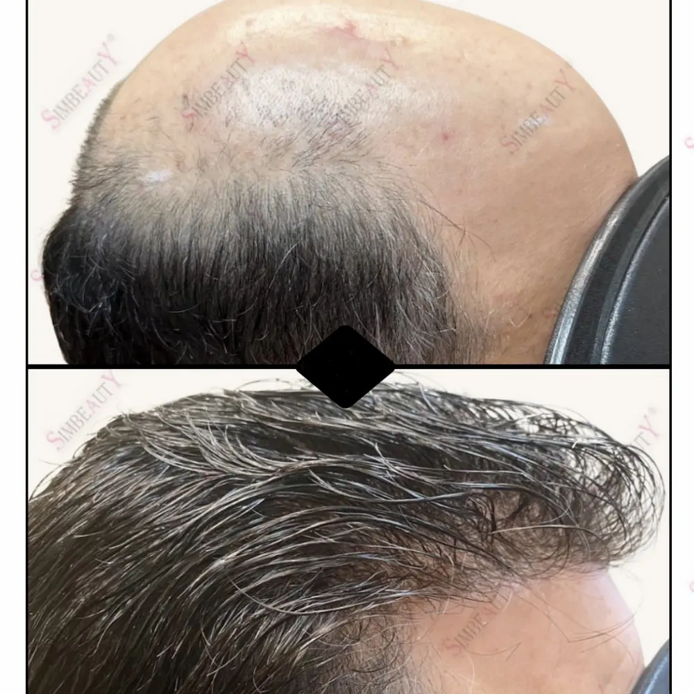 

Realistic Light Weight0.02mm Super Ultra Thin Skin Men's Toupee 80Density Natural Hairline VLoop Human Hair Invisible Prosthesis