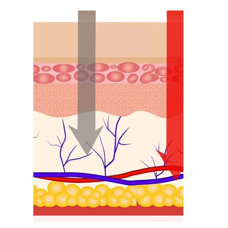 A85I-علاج فطريات الأظافر 905Nm ضوء الأشعة تحت الحمراء 470Nm الضوء الأزرق للعناية الشخصية بالأظافر
