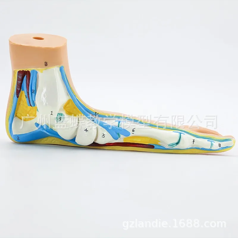 Medical Human  Sketelon  Flatfoot, Arch Foot and Normal Foot Anatomy Model with Muscles and Joints for Educational Purposes