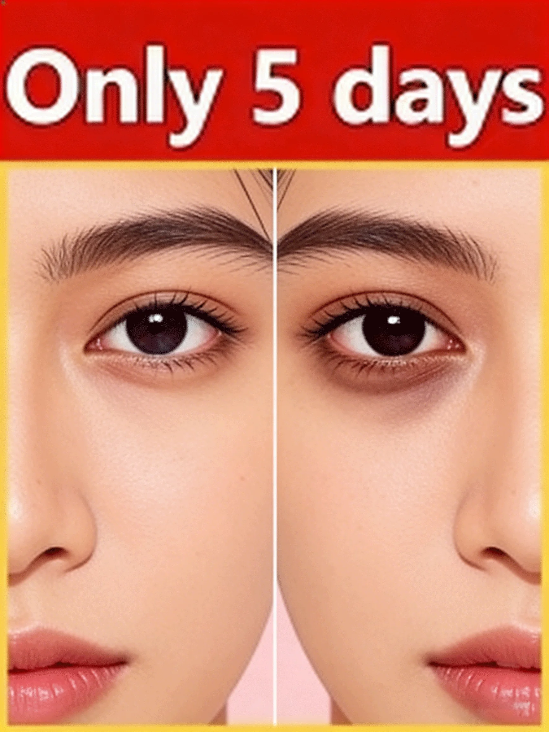 

Крем для удаления мешков под глазами, против морщин, от темных кругов, восстанавливающий поврежденную кожу, увлажняющий, для ухода за кожей вокруг глаз