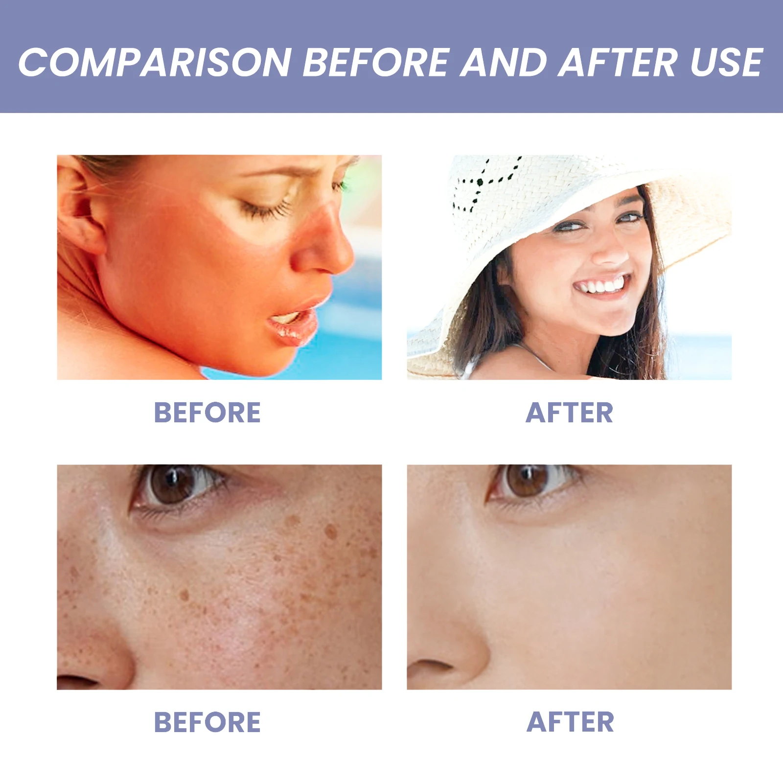 مصل الوجه EELHOE مع الكولاجين المغذي للعناية بالبشرة، ترطيب منعش، ترطيب، مغذي، مجموعة العناية بالبشرة