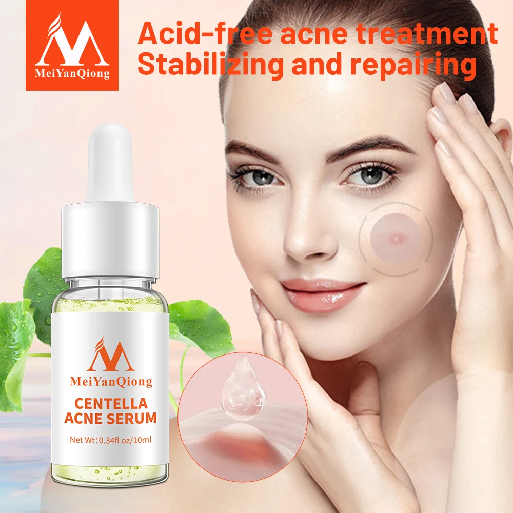 

Centella Asiatica Acne Removing Essence Moisturizing Face Serum Shrink Pore Control Oil Liquid Anti Wrinkle Whiten Skin Beauty