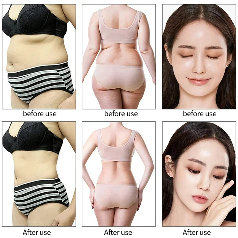 9 in 1 Ultrasound Vacuum Fat Reduction 40K Multifunctional Skin Lifting And Firming Weight Loss Body Slimming Device for Women