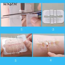 1/3/10Pcs Zipper Tie Wound Closure Patch Hemostatic Patch Wound Fast Suture Zipper Band-Aid Outdoor Portable Skin Care