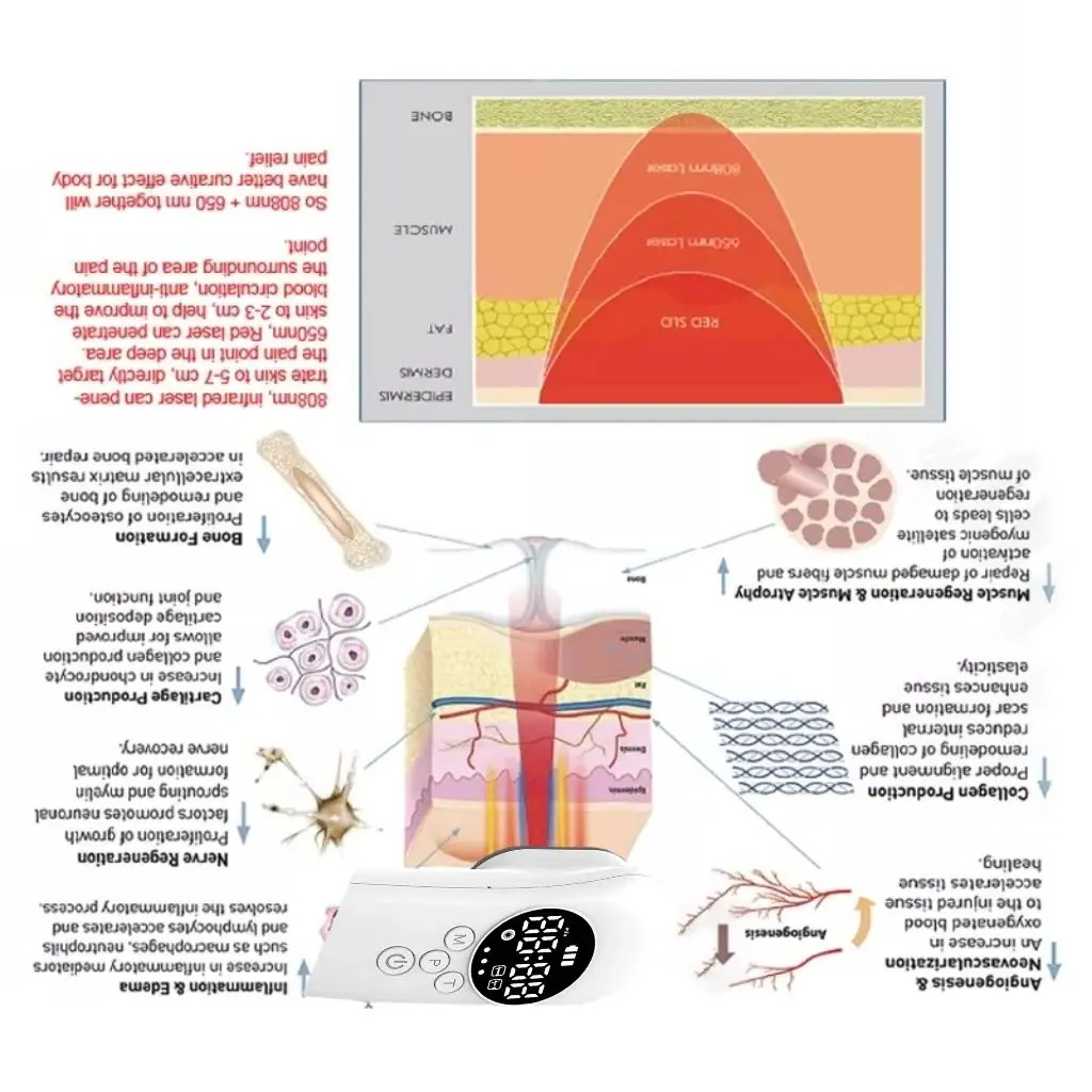 

650 нм + 808 нм низкоуровневое мягкое холодное лазерное физиотерапевтическое устройство для облегчения боли в мышцах суставов 520 МВт