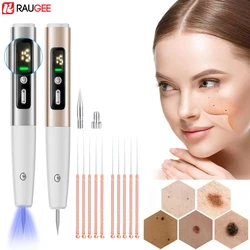 Laser Plasma Pen Electric Skin Tag Removal Black Dots Laser Plasma Pen Wart Spot Freckle Dark Dot Nevus Flat Tattoo Mole Remover