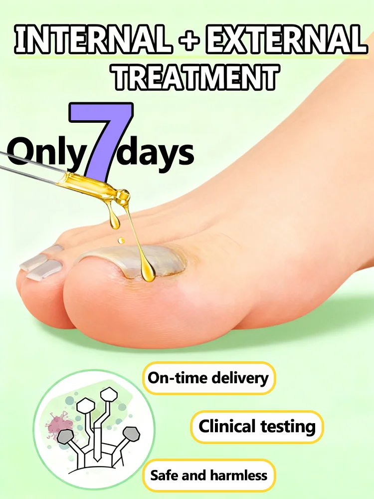 フットケア：細部の美しさを明らかにする！迅速な効果をもたらす！