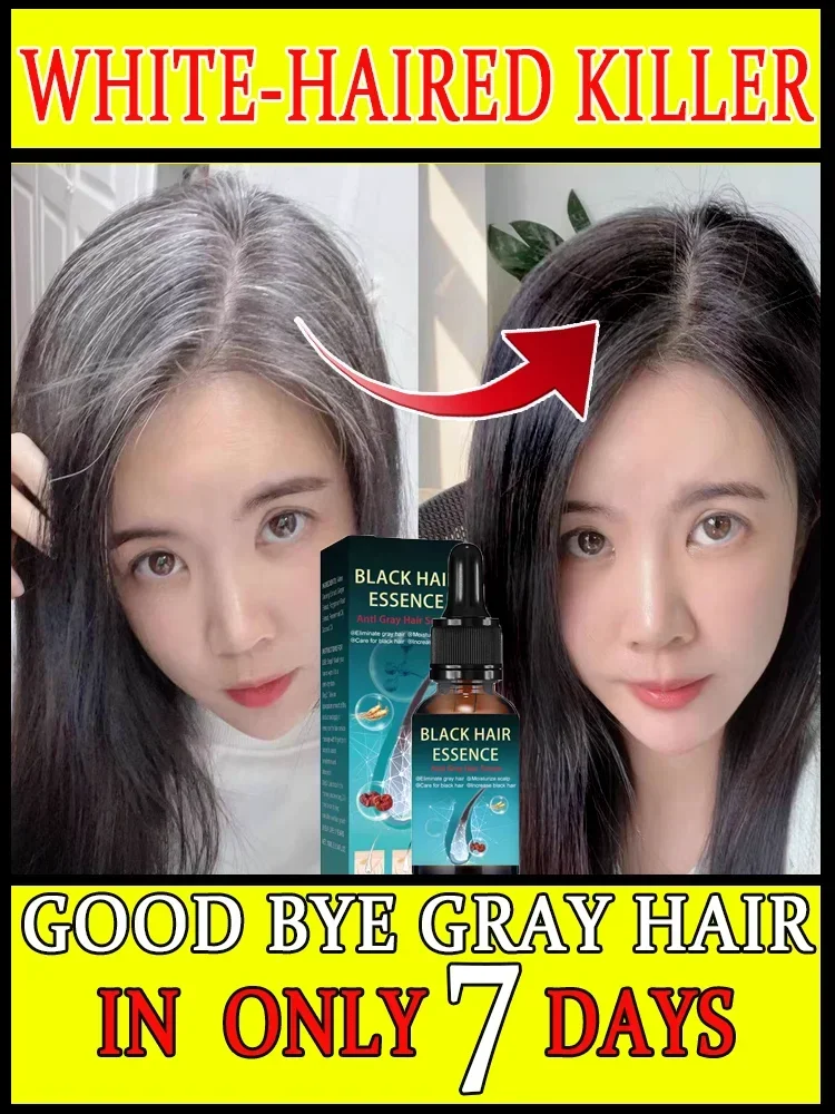 

Turn white hair into black hair, remove white hair, turn gray within 7 days, restore natural health V