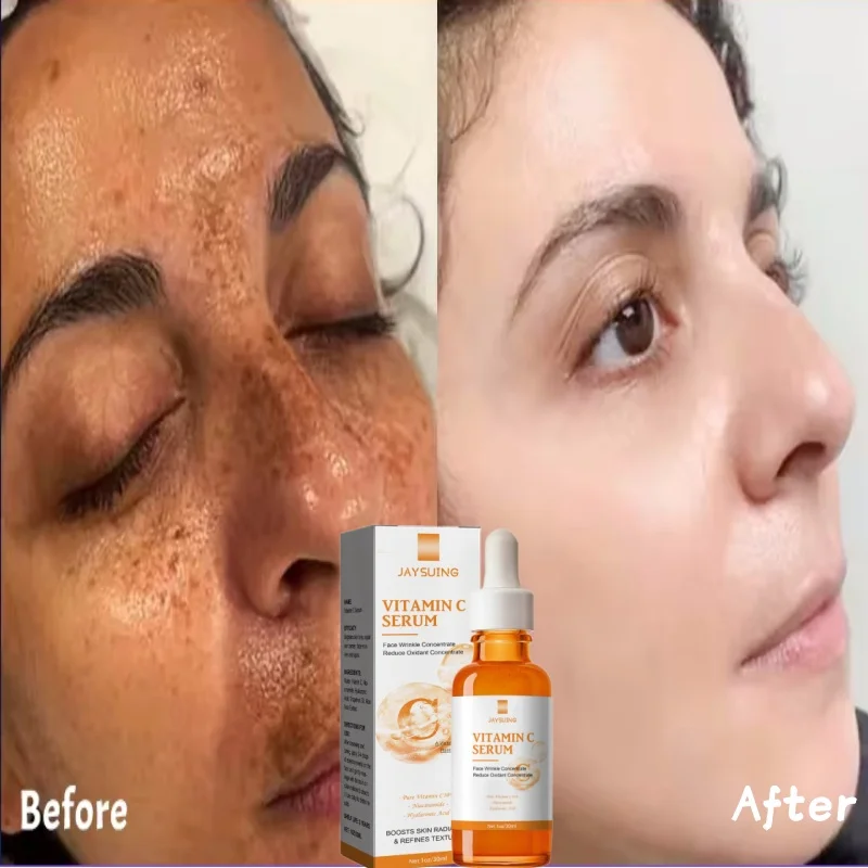 

Vitamin C Whitening Serum Face Remove Dark Spots Freckles Fade Melanin Retinol Anti-wrinkle Essence Brightening Korean Skin Care