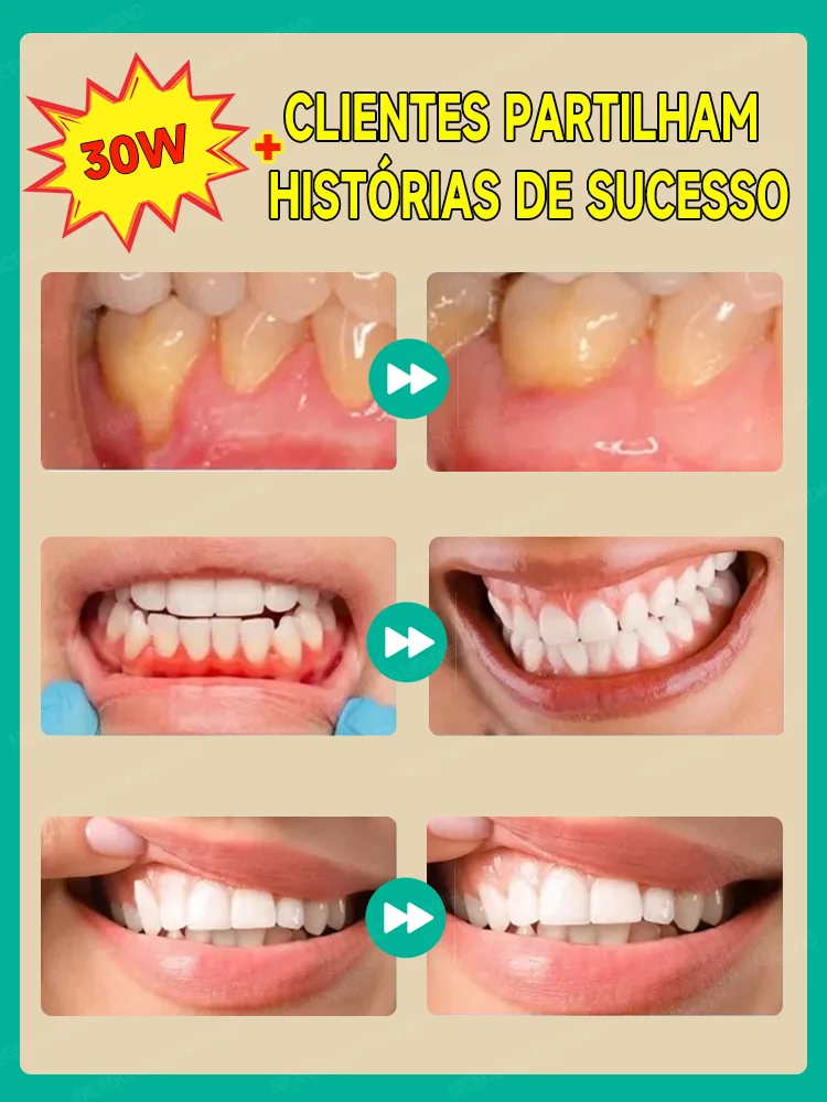 Aliviar Rapidamente A Dor De Dente, Reparar Gomas Danificadas, Gomas De Goma Saudáveis