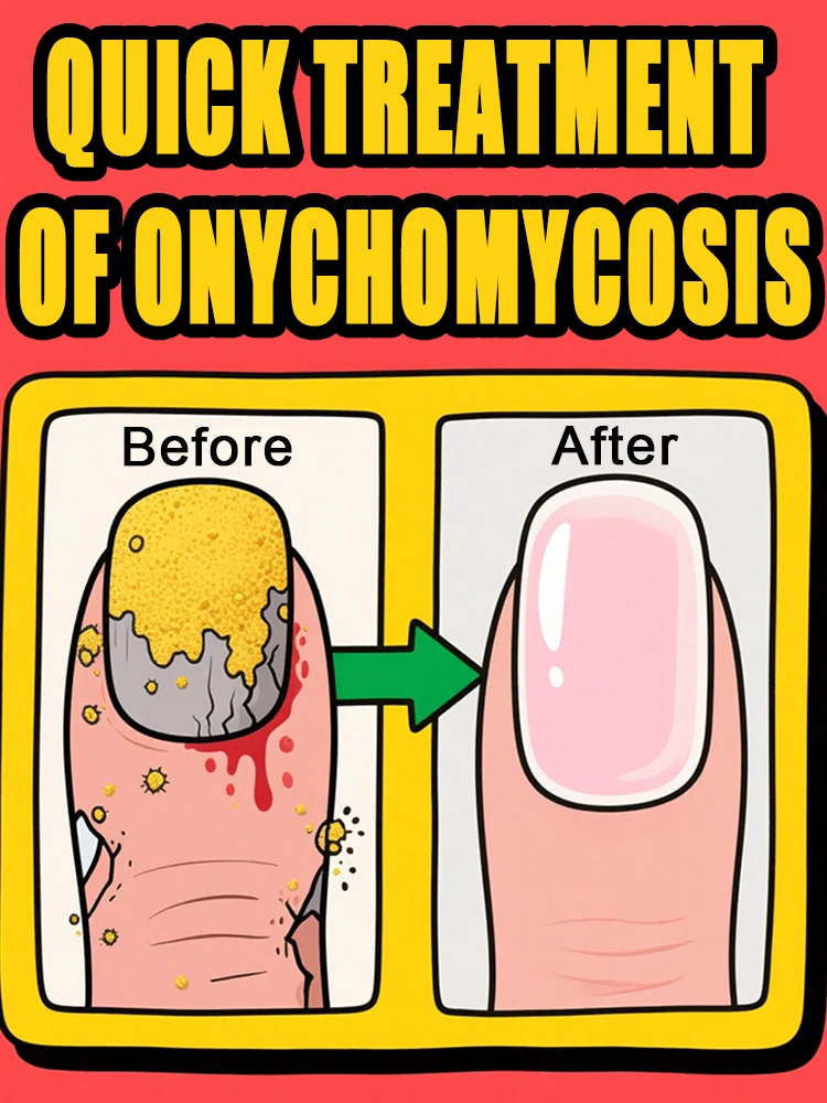 

ᵀʳᵉᵃᵗⁱⁿᵍ ᵒⁿʸᶜʰᵒᵐʸᶜᵒˢⁱˢ ⁿᵒʷ ⁱˢ 2 times faster than in autumn and winter