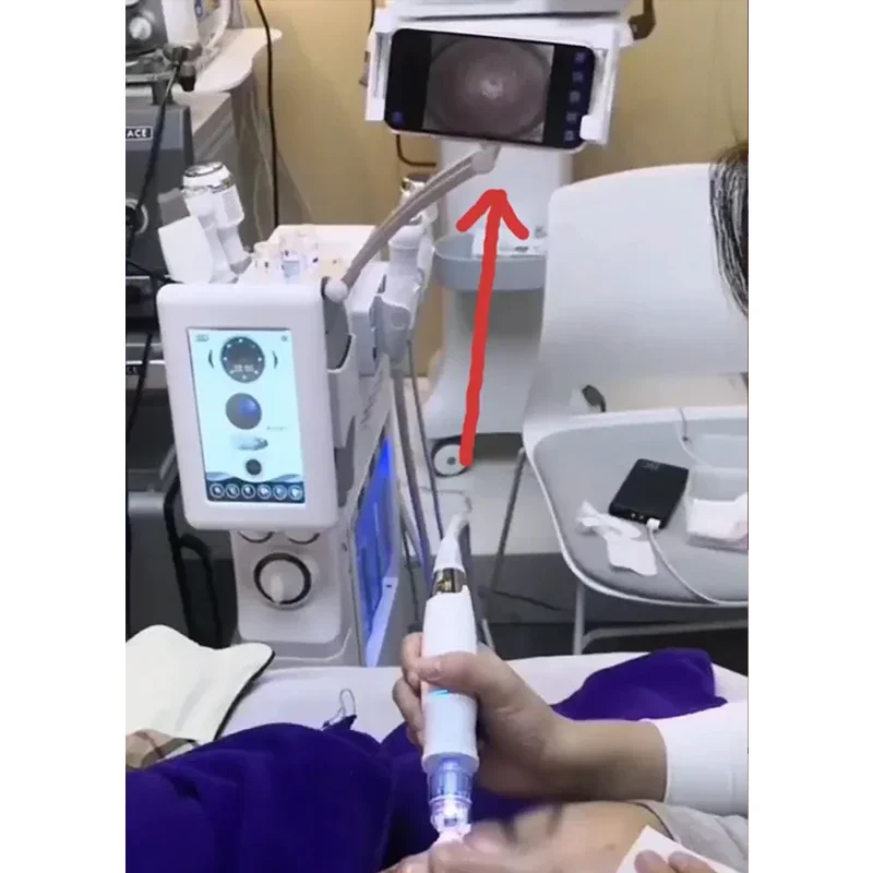 6-in-1 HydroFacial Machine with Camera | Visible Blackhead Removal | Deep Cleansing & Face Lifting | Professional Spa Device