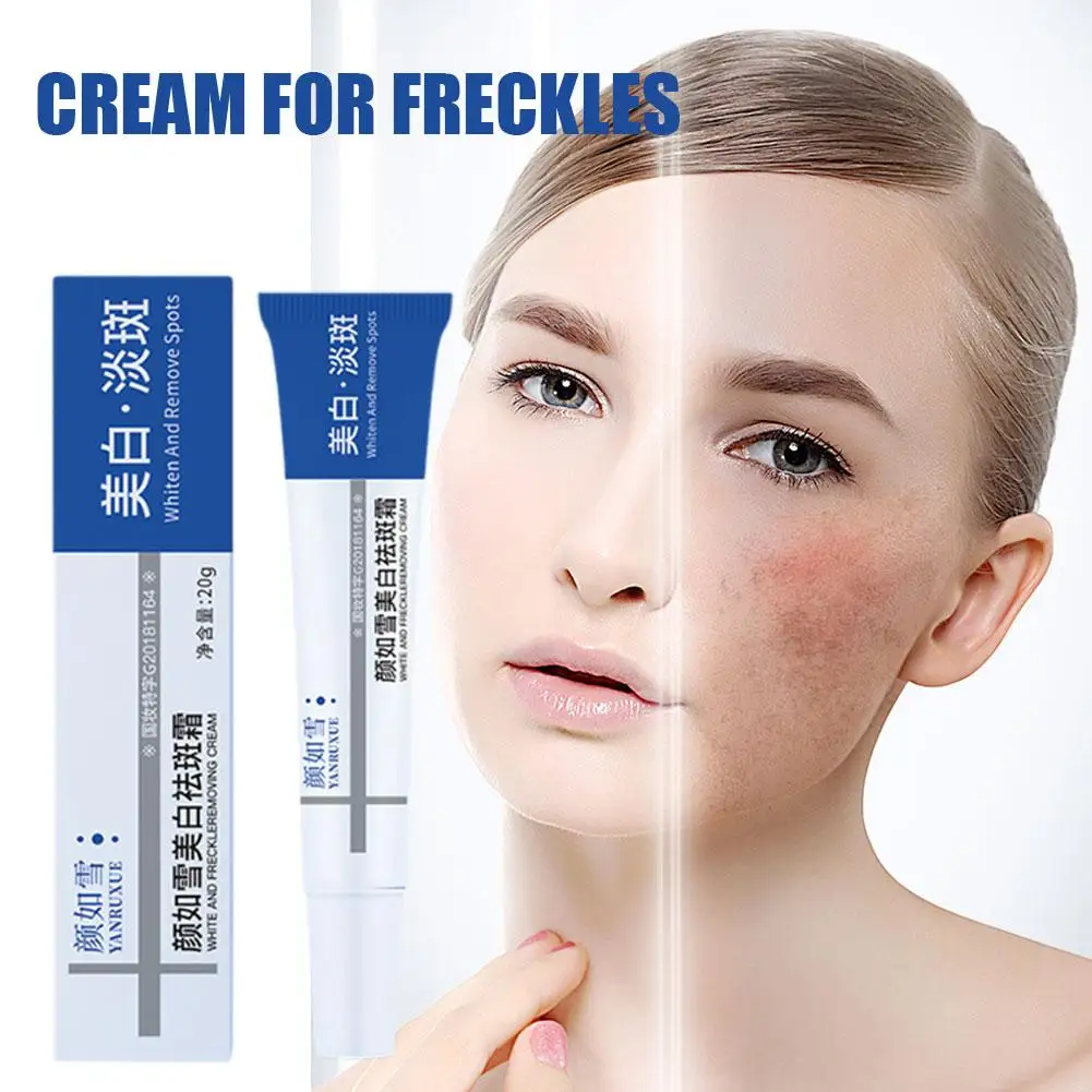 Creme De Sardas De Clareamento Eficaz, Remover Melasma Escuro, Hidratar o produto do cuidado do rosto, Pontos de pigmentação da pele iluminam desvanecem-se, G9e5