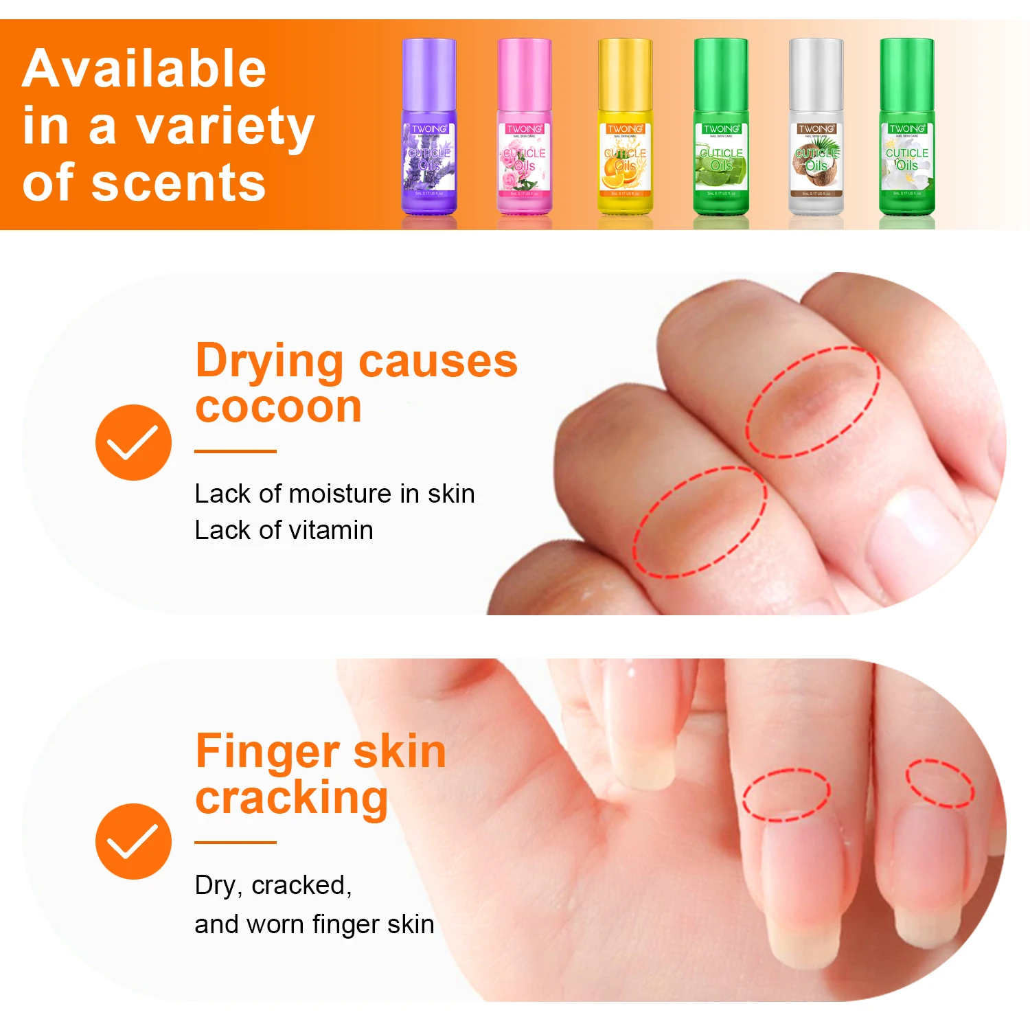 TWOING 5 مللي زيت تغذية الأظافر علاج الأظافر زيت إصلاح البشرة منع Agnail طلاء الأظافر تغذي الجلد علاج أداة العناية بالأظافر