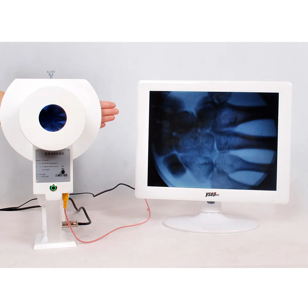 Máquina de raio X à mão portátil do Vet, máquinas humanas de Digitas