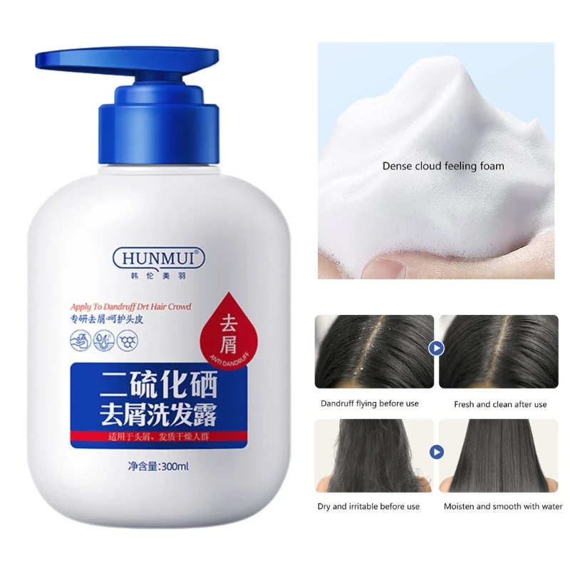 300ml Selenium Disulfide Shampoo Smoothing Moisturize Anti-Dandruff Itching Anti-hair Loss Oil Control Nourishing Drop Shipping