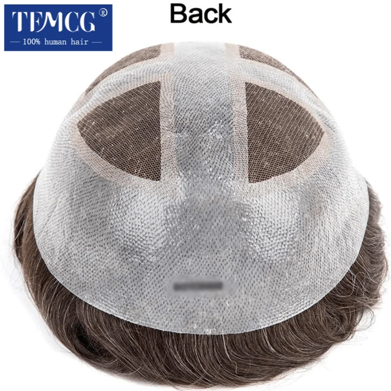 Рисунок 6 - Мужской протез для волос Douglas