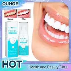 Dentifrice mousse pour le blanchiment des dents, nettoyage en profondeur de la plaque dentaire, réparation SAF, éclaircissant, haleine fraîche, mousse de soins d'hygiène buccale