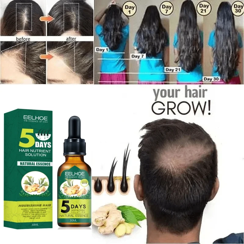 Óleo essencial de gengibre para o crescimento do cabelo, essência anti-perda, reparação do couro cabeludo, danos, crescer, nutriir, couro cabeludo,