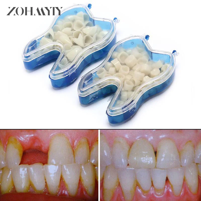 Couronne temporaire en porcelaine dentaire, couronne pour dents antérieures et postérieures, équipement buccal, 50 pièces