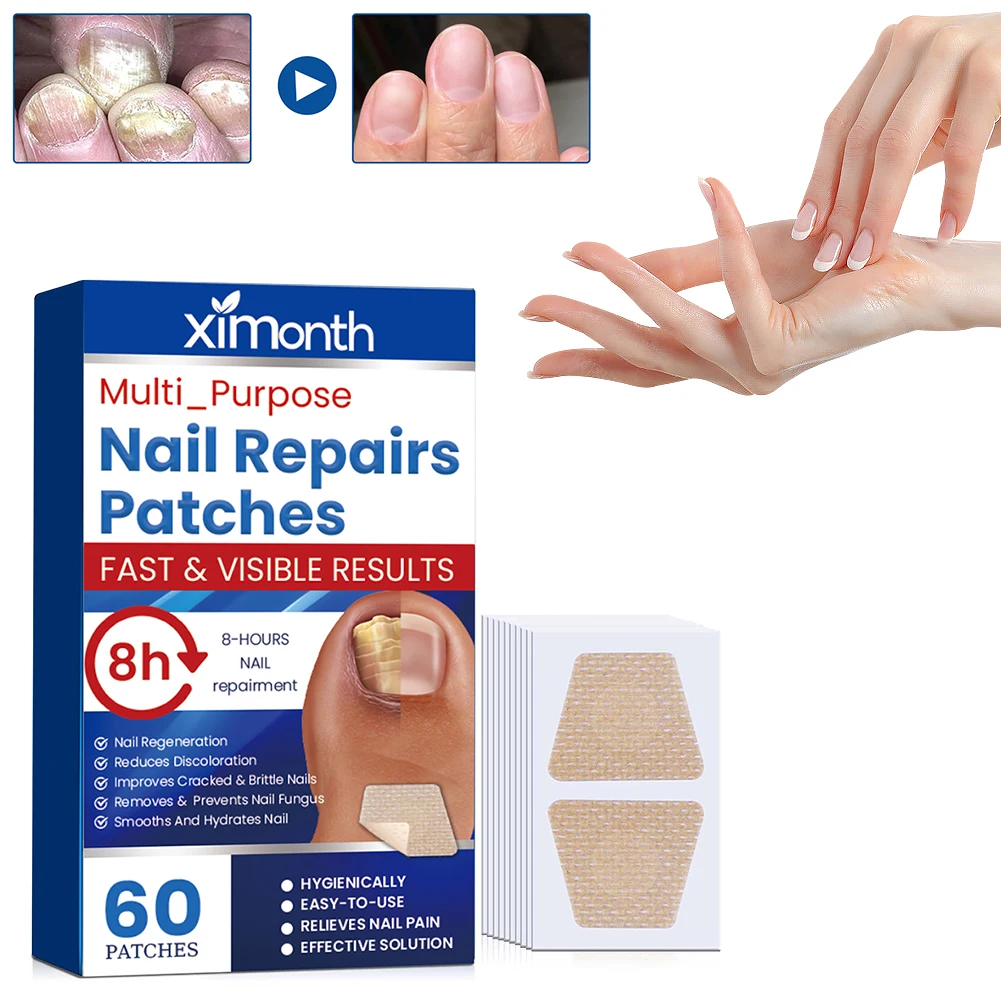 60Pcs Nail Ingrown Correction Stickers Breathable Nail Repair Patches Nail Repair Stickers for Discolored Or Damaged Nails