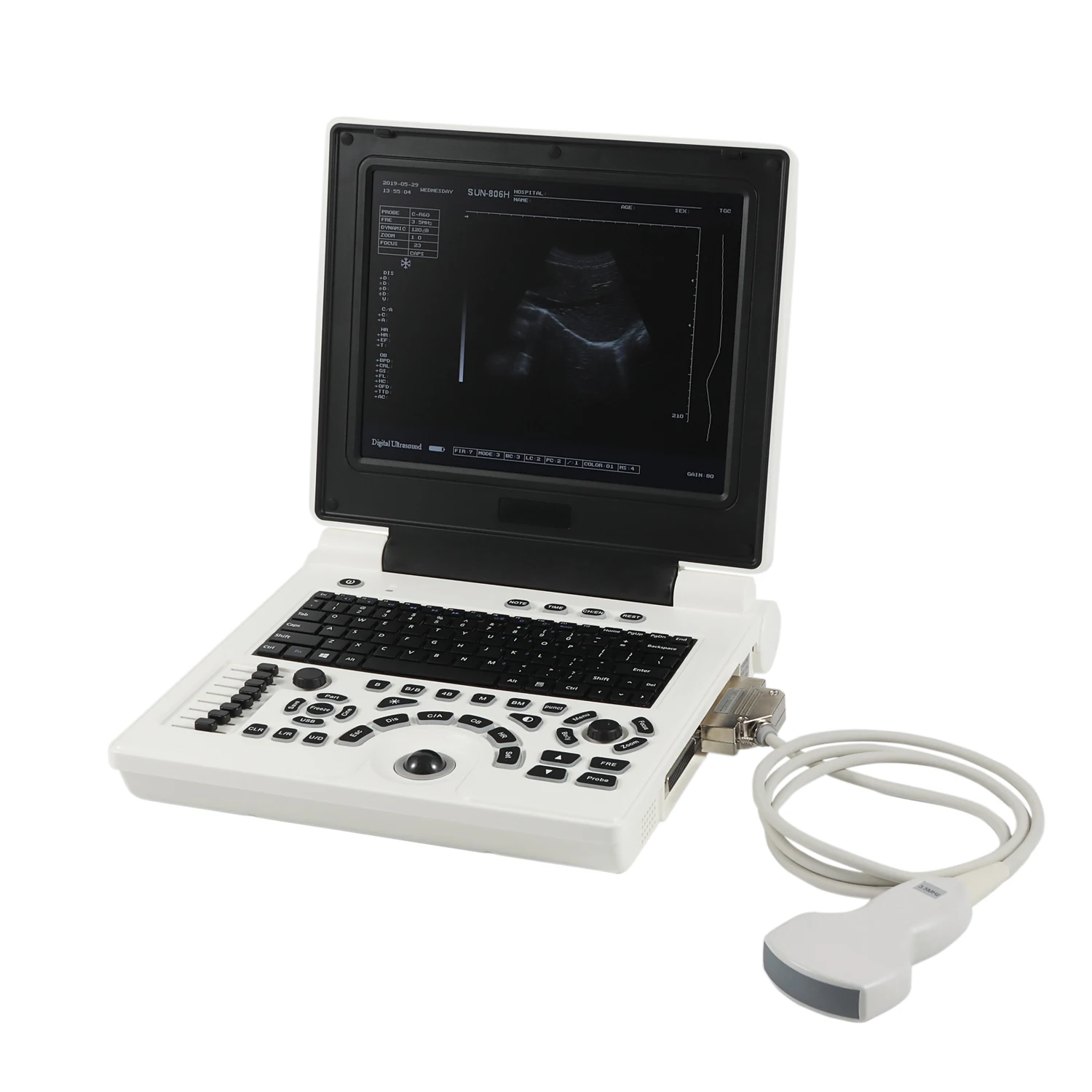 

Diagnostic B&W Portable Ultrasound Machine Ultrasound Scanner For Sale