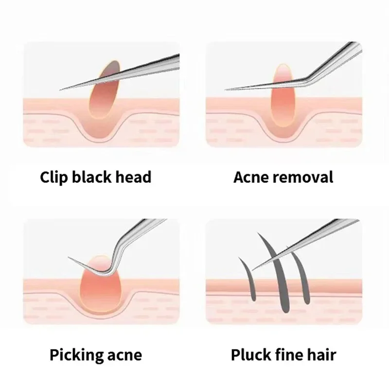 เข็มแหนบสำหรับสิวหัวดำเบาๆกำจัดสิวชี้จุดโค้งงอเครื่องมือดูแลผิวหน้าเข็มเจาะหัวสิวความงาม-สุขภาพ