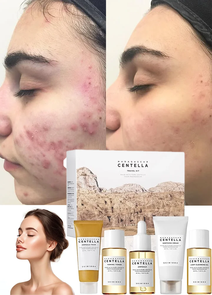 

Korean Skin Care Centella Travel Kit Toner, Ampoule, Soothing Cream, Cleansing Oil, Foam, Basic Skincare Box Gift Set