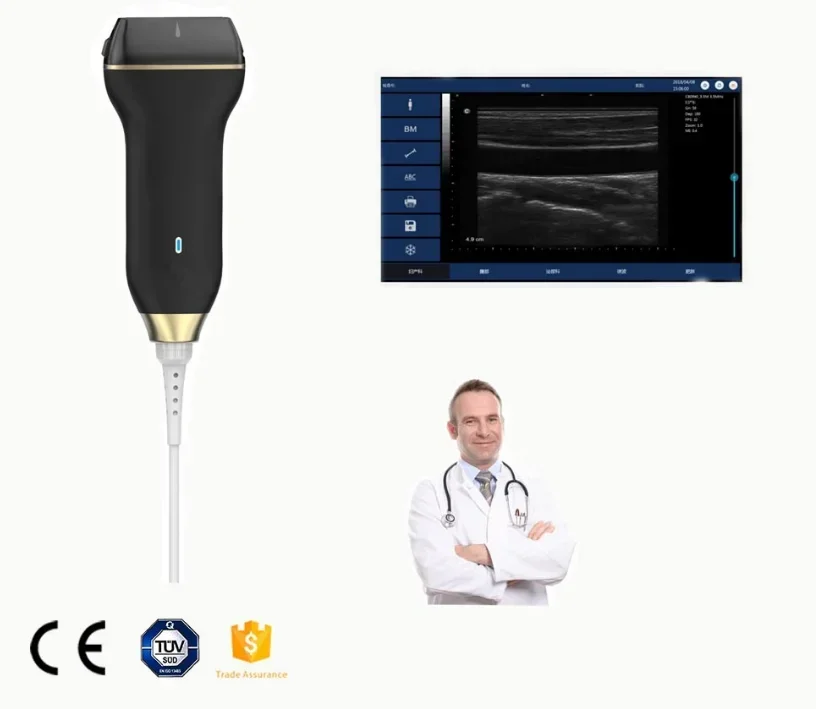 Mobile USB smart color doppler Black and White handheld ultrasound scanner medical wireless ultrasound probe