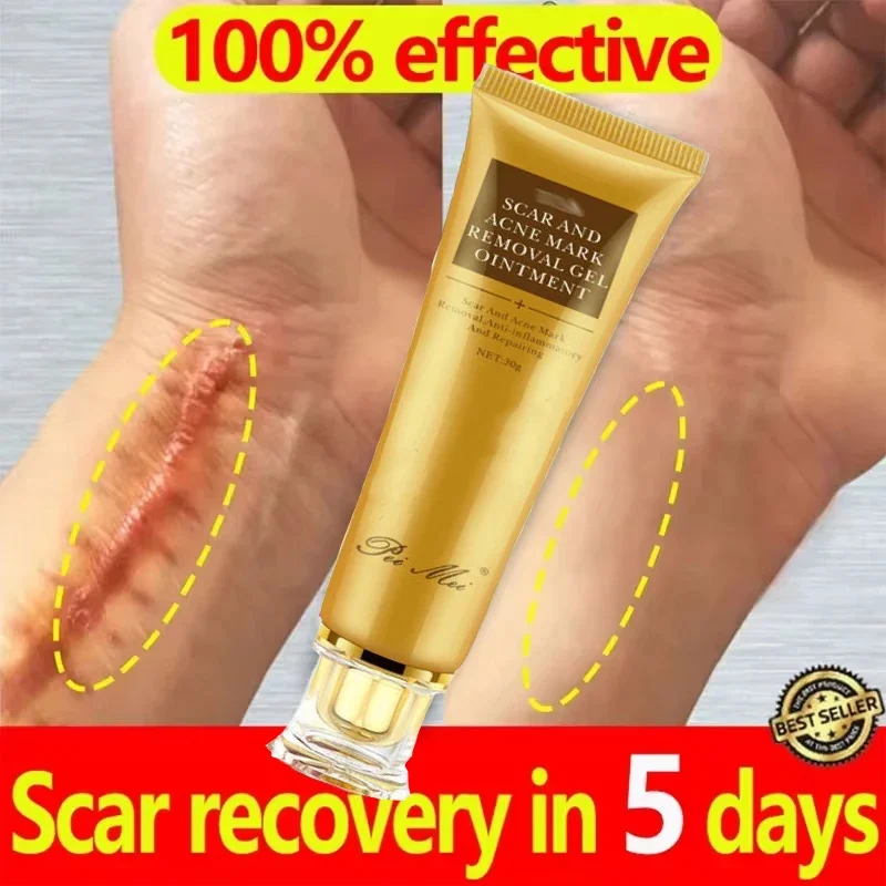 Fast Scar Removal Cream Treatment Stretch Marks Burn Surgical Scars Acne Spot Repair Whiten Moisturizing Skin Care Beauty Health