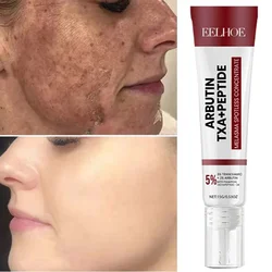 Bleaching Sommersprossen Creme Melasma dunkle Flecken Pigmenten tfernungs produkte verblassen Fleck Melanin Reparatur erhellen koreanische Hautpflege