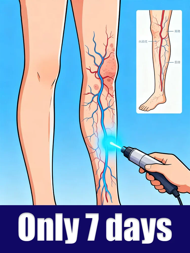 Praktische Werkzeuge zur Behandlung venöser Anormalitäten und Lasertechnik