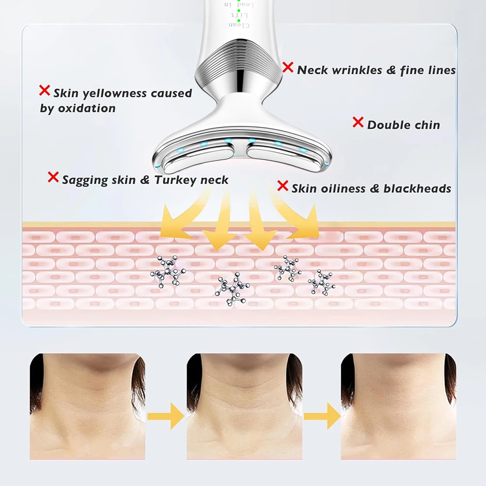 Nieuwe 3-In-1 Led-Apparaat Voor Het Opwarmen Van De Nek Voor Oogmassagevibratie In Het Gezicht Van Het Gezicht Slanker Ems Dubbele Kingezichtsmassageapparaat